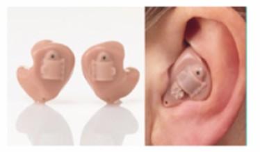耳内式助听器特点-什么是耳内式助听器
