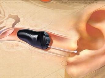 人工耳蜗与助听器有什么不同