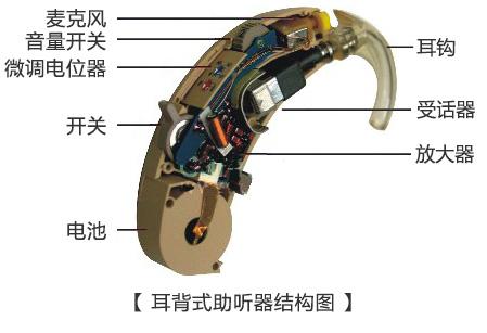 为什么配助听器要检查听力