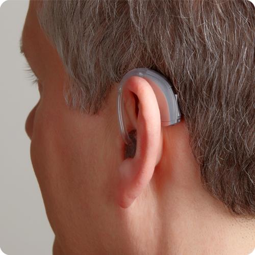 助听器是要等全聋了再配吗？